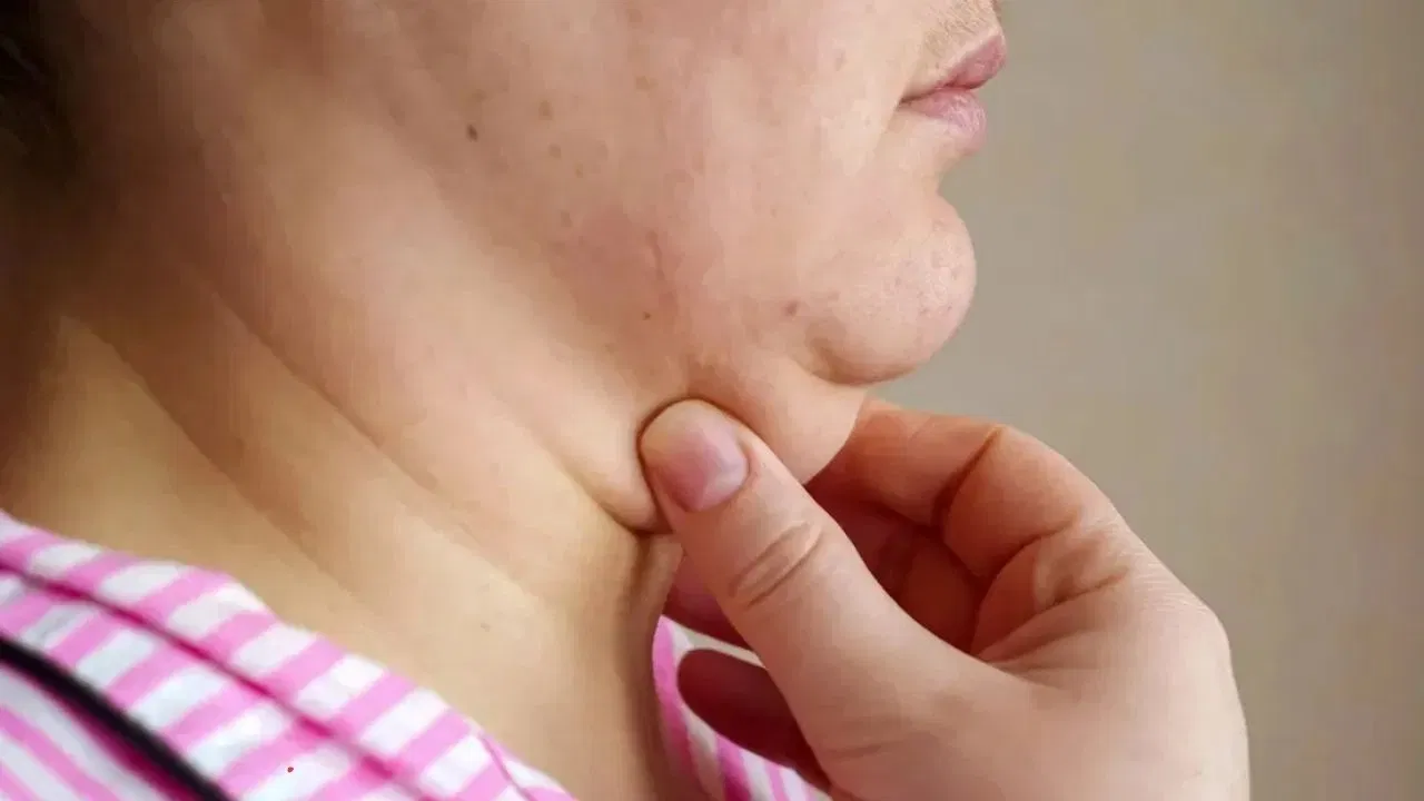 ডিম মাখলেই দূর হবে ডাবল চিন! 